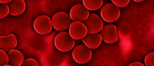 Vitamin K2 Supplementation May Benefit Dialysis Patients by Inhibiting Vascular Calcification