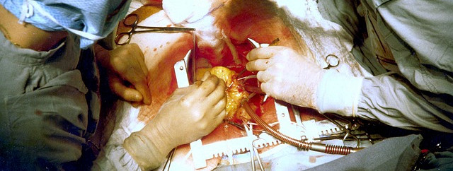 Statins Inhibit Vitamin K2 and Stimulate Hardening of the Arteries: New Review Paper